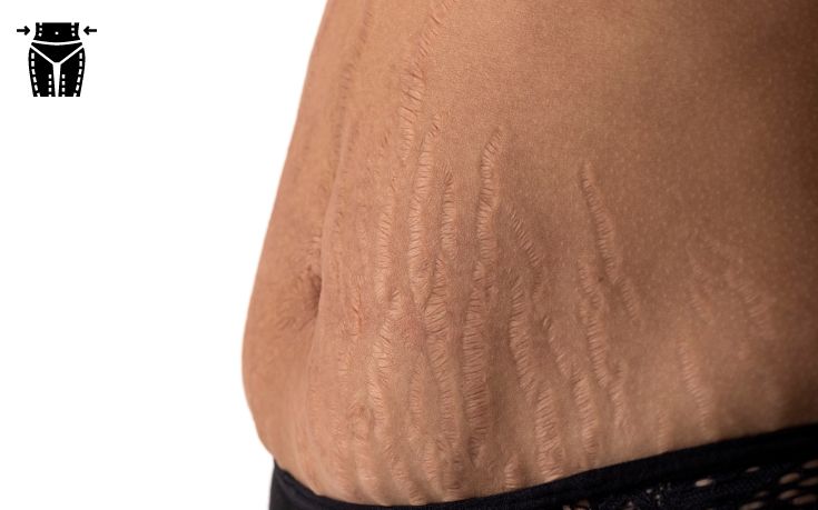 Remove Surgery Marks